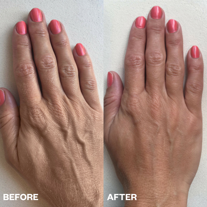 Hand Wrinkle Patches