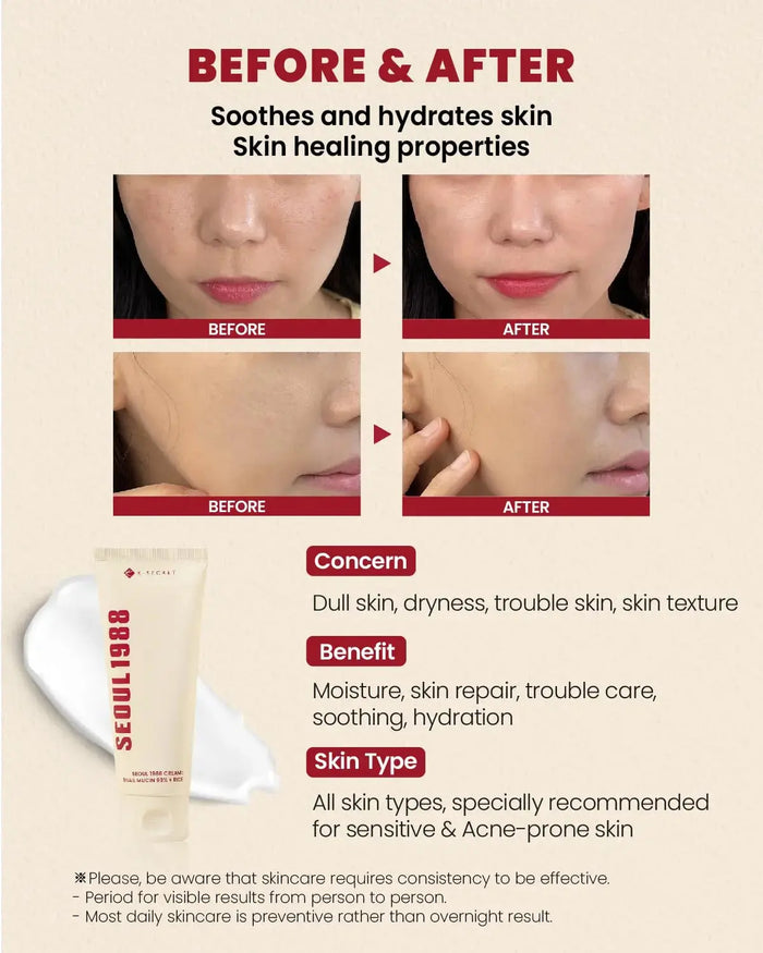 SEOUL 1988 Cream: Snail Mucin 93% + Rice 100 ml - DOKAN